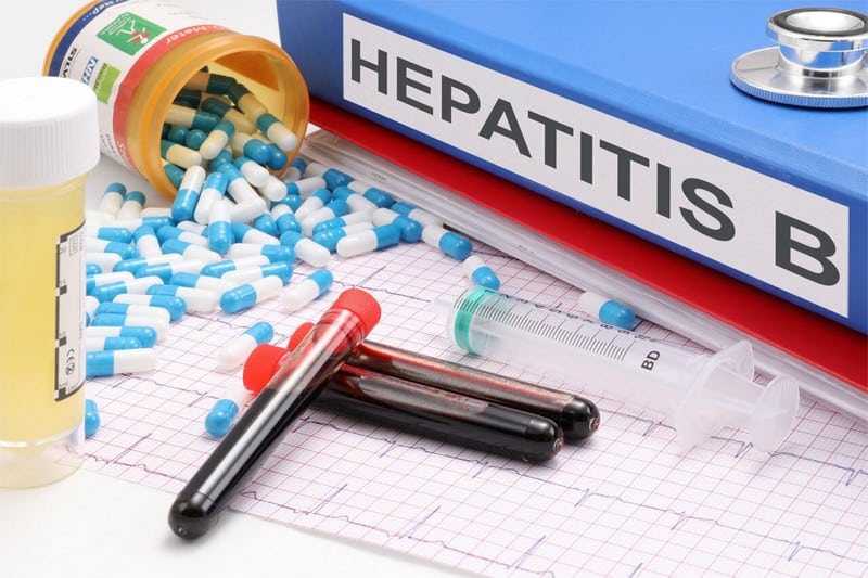 How To Treat Hepatitis B: 14 Treatments Professionals Recommend ...