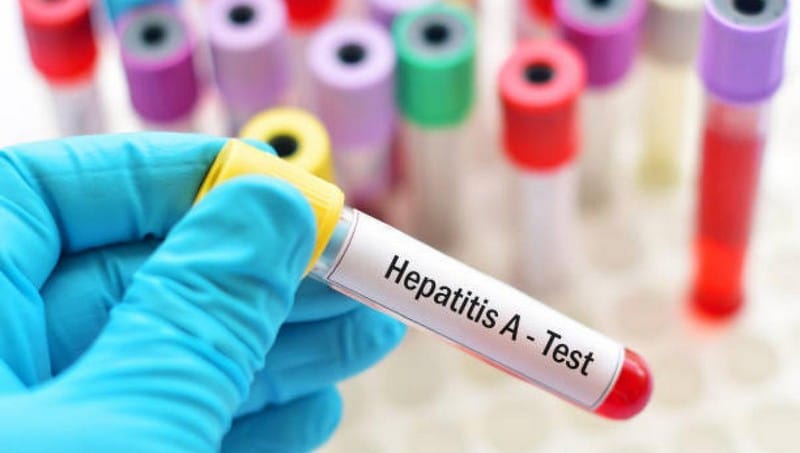 Top 12 Hepatitis A Treatments You Should Know - OptingHealth