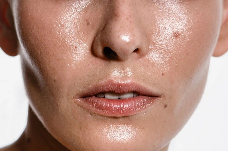 What Causes Dry Eyelids 15 Common Causes You Should Know Optinghealth 